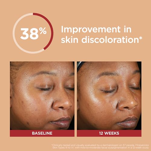 EltaMD UV Clear Deep Tinted Sunscreen for Face SPF 46, With Zinc Oxide, Oil-Free, Lightweight, For Acne-Prone Sensitive Skin, Dermatologist Recommended, 1.7 oz