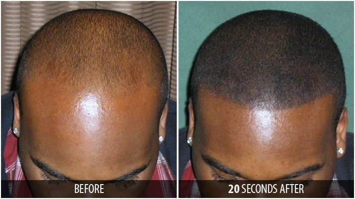 Dr. Yates MD Keratin Fiber Hair Enhancer (Auburn)
