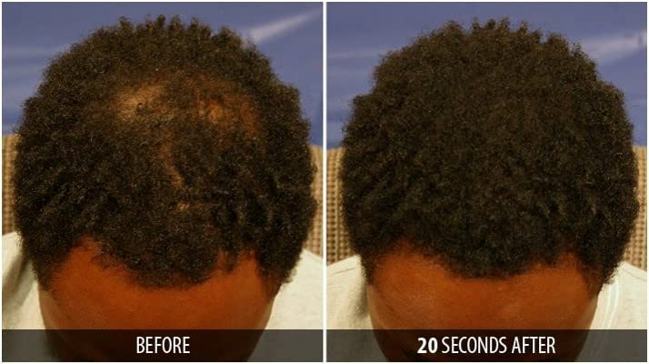 Dr. Yates MD Keratin Fiber Hair Enhancer (Auburn)