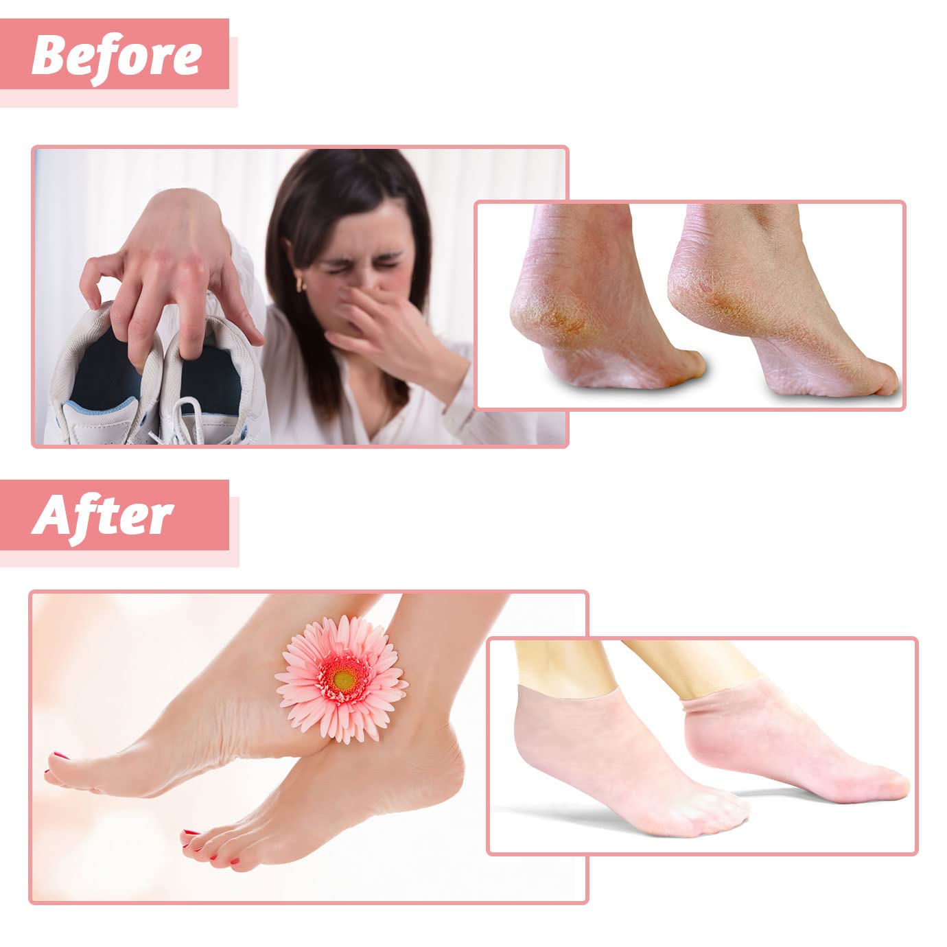 3 Pairs Silicone Socks, Silicone Moisturizing Socks Aloe Socks Silicone Gel Heel Socks for Women Men Dry Cracked Foot Skin(Medium, 3 Colors)