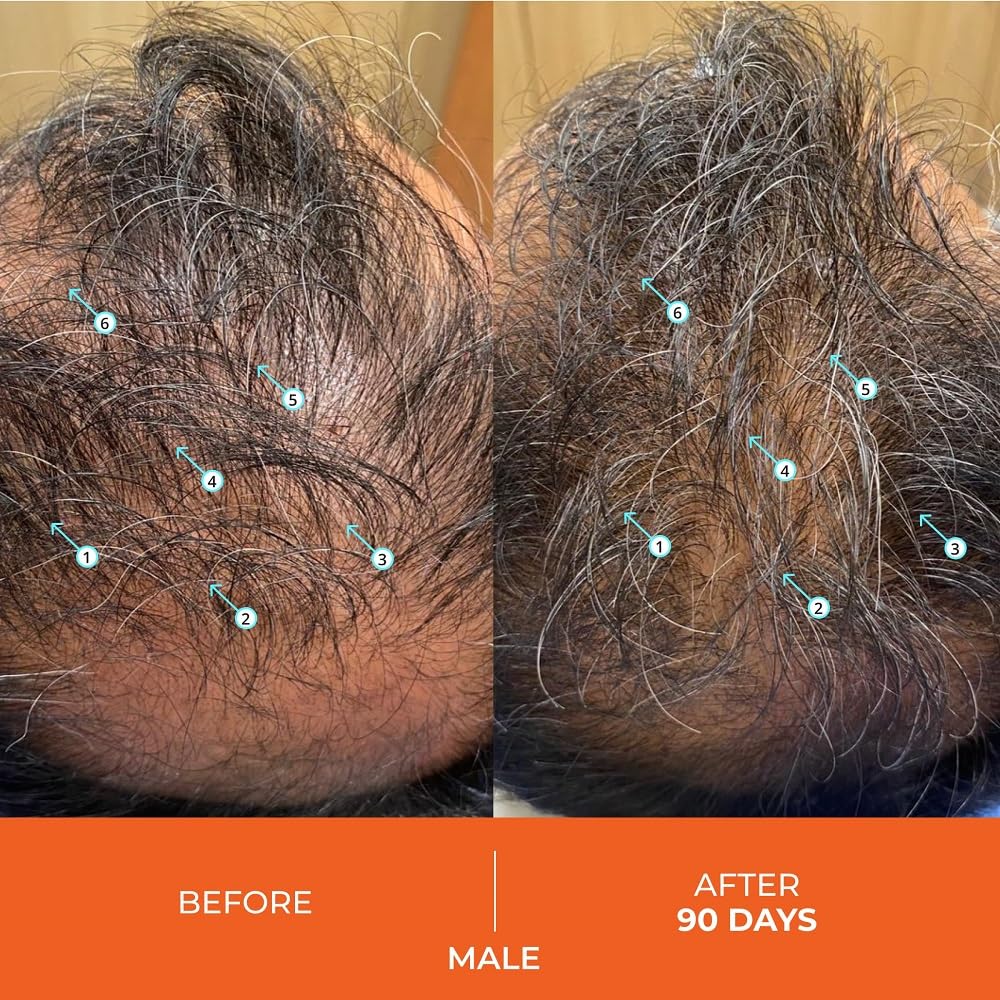 DS Laboratories Revita Hair Growth Conditioner for Fine & Thinning Hair, Biotin Treatment for Hair Regrowth, Thickening & Loss Prevention