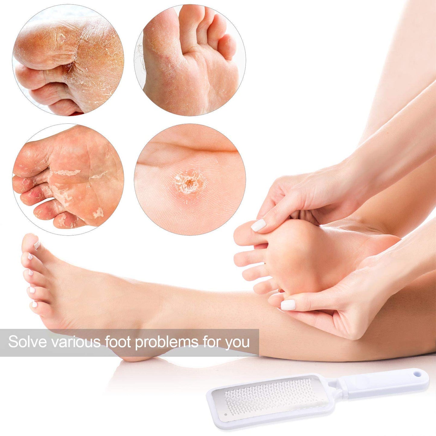 3 Pieces Foot Files Kit Foot Scrubber Colossal Foot File Callus Remover for Dead Skin Foot Grater Pedicure Tools Callus File for Feet