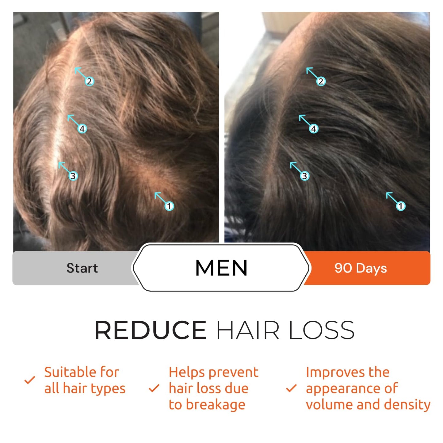 DS Labs Revita Shampoo Travel Size – High-Performance Hair Density Shampoo, Volumizing & Thickening, Fuller, Healthier-Looking Hair, Sulfate & Silicone Free, For Men & Women, 100mL