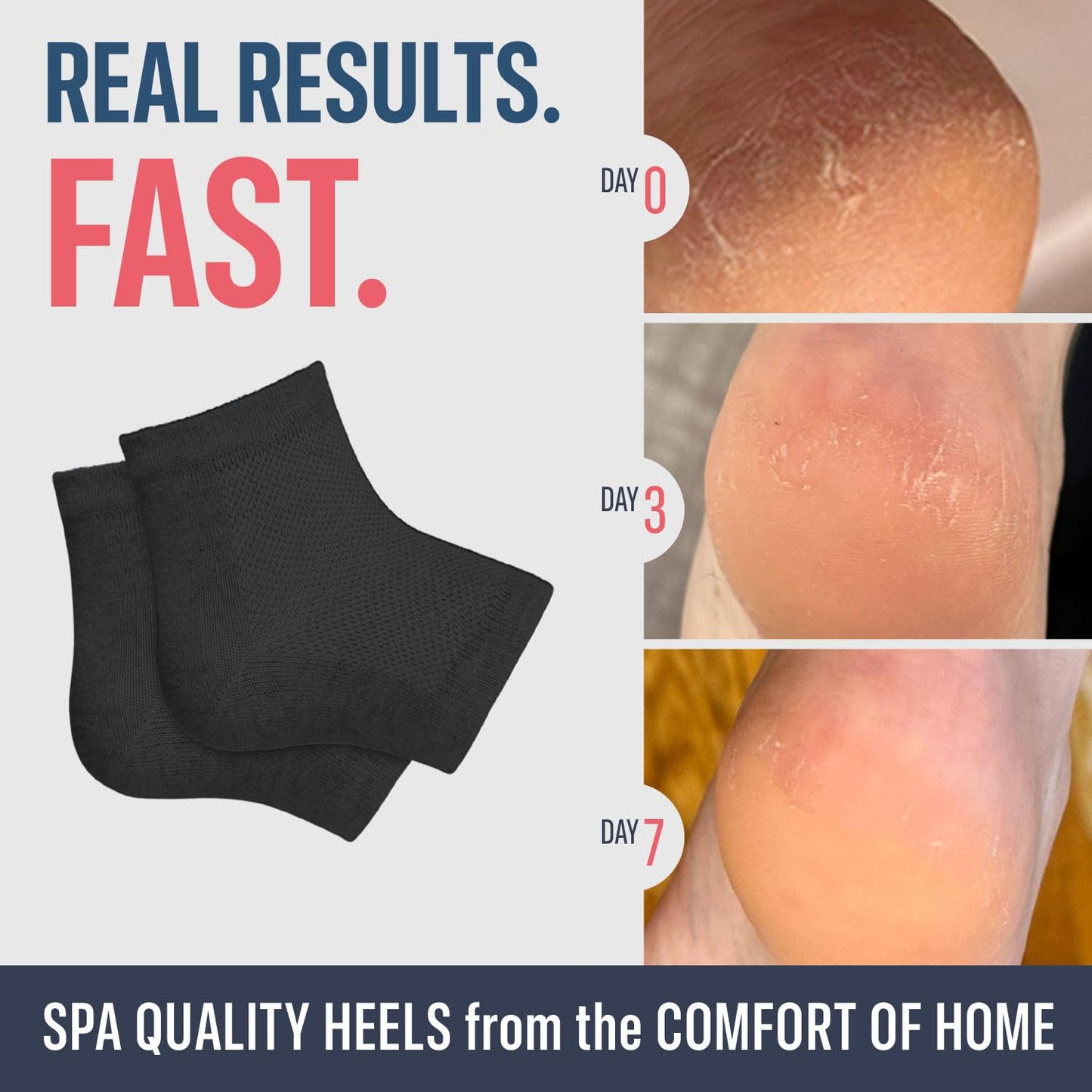 Dr. Frederick's Original Moisturizing Heel Socks for Cracked Heel Treatment - 2 Pairs - Socks for Dry Feet - Cracked Skin Repair & Overnight Hydration - Foot Care for Women & Men - Argan Oil