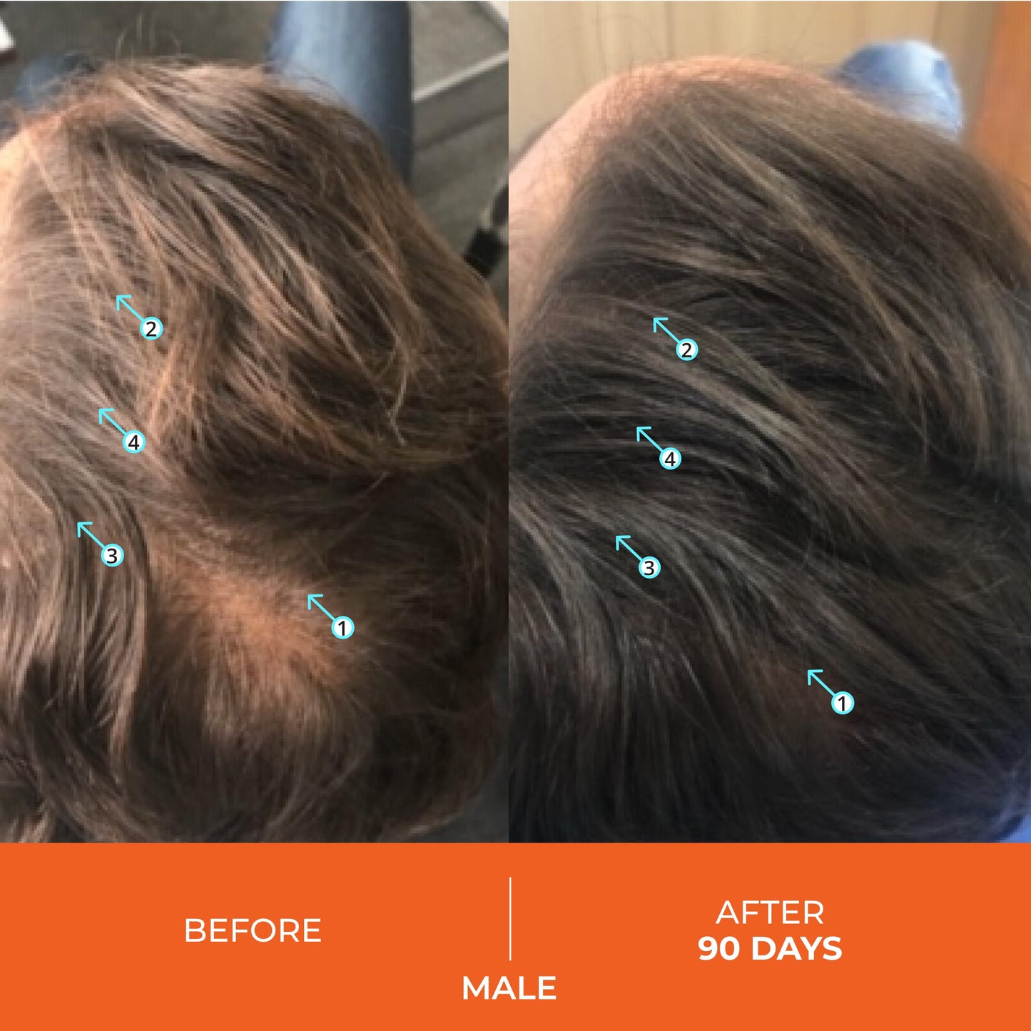 DS Laboratories Revita Shampoo - Hair Thickening Shampoo, DHT Blocker Biotin Shampoo, Hair Thickening Products for Men & Women to Support Hair Growth, Packaging May Vary