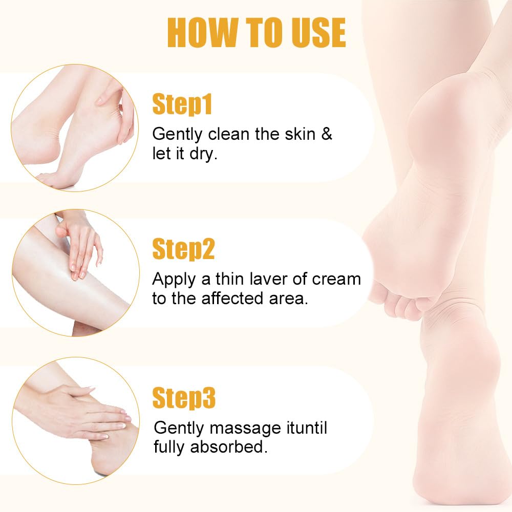 2 Pcs 60% Urea Cream plus 2% Salicylic Acid Foot Cream for Removing Calloused Skin, Cracked Hands Feet Moisturizes & Hydrates, Maximum Strength Skin Barrier Repair Hand Cream (White)