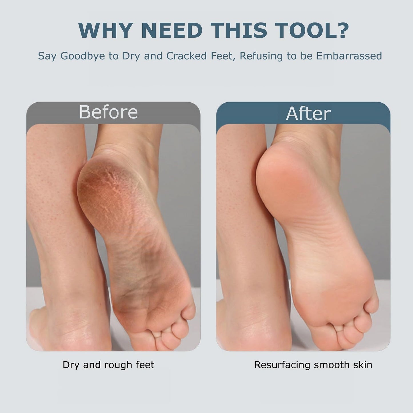 Electric Foot Callues Remover - FSA&HSA Eligible, Portable Electric Foot Files with 3 Heads, Rechargeable Feet File for Foot Care, Waterproof Deadskin Remover, Pedicure Tool for Dry and Crack Feet