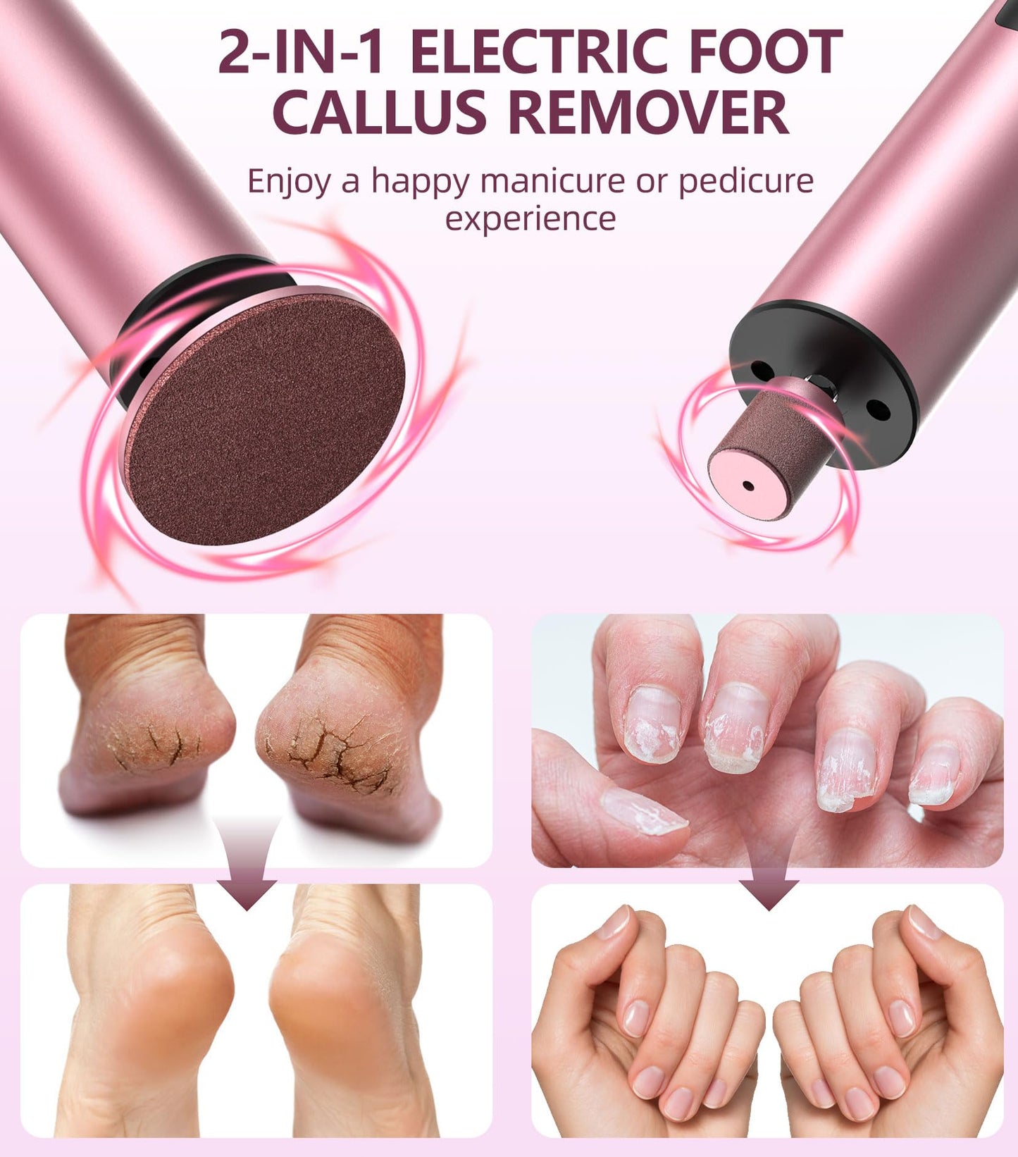 Electric Foot Callus Remover(6 Speed), 2 in 1 Electric Foot File Nail Grinder, Rechargeable Foot Sander with Sandpaper Disk and Nail Drill Bits, Callus Remover for Feet for Dead Skin-Pink