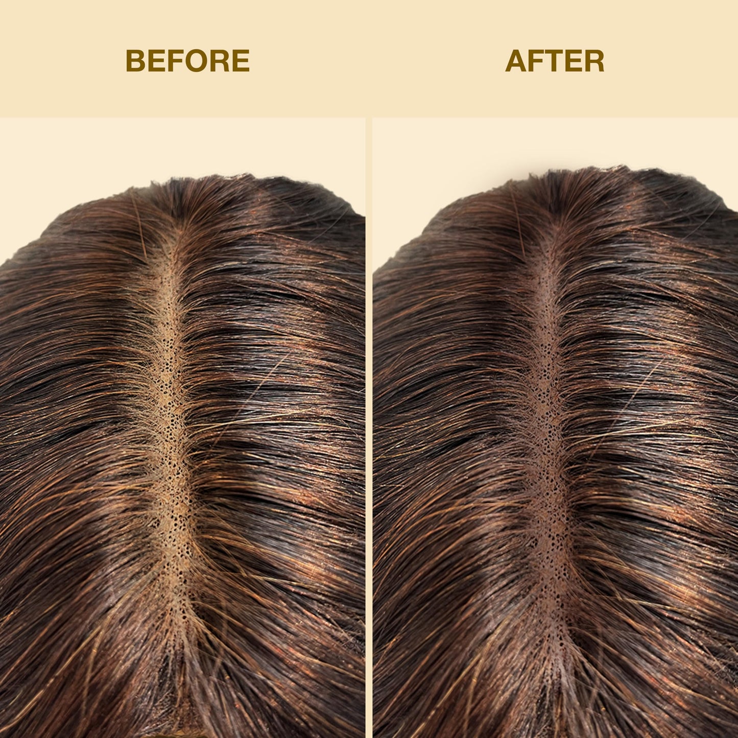EBIN NEW YORK Tinted Lace Spray - Dark Brown 2.7oz/ 80ml, Quick dry, Water Resistant, No Residue, High pigmentation, Even Spray, Matching Skin Tone, Natural Look, Tinted Spray for Wig